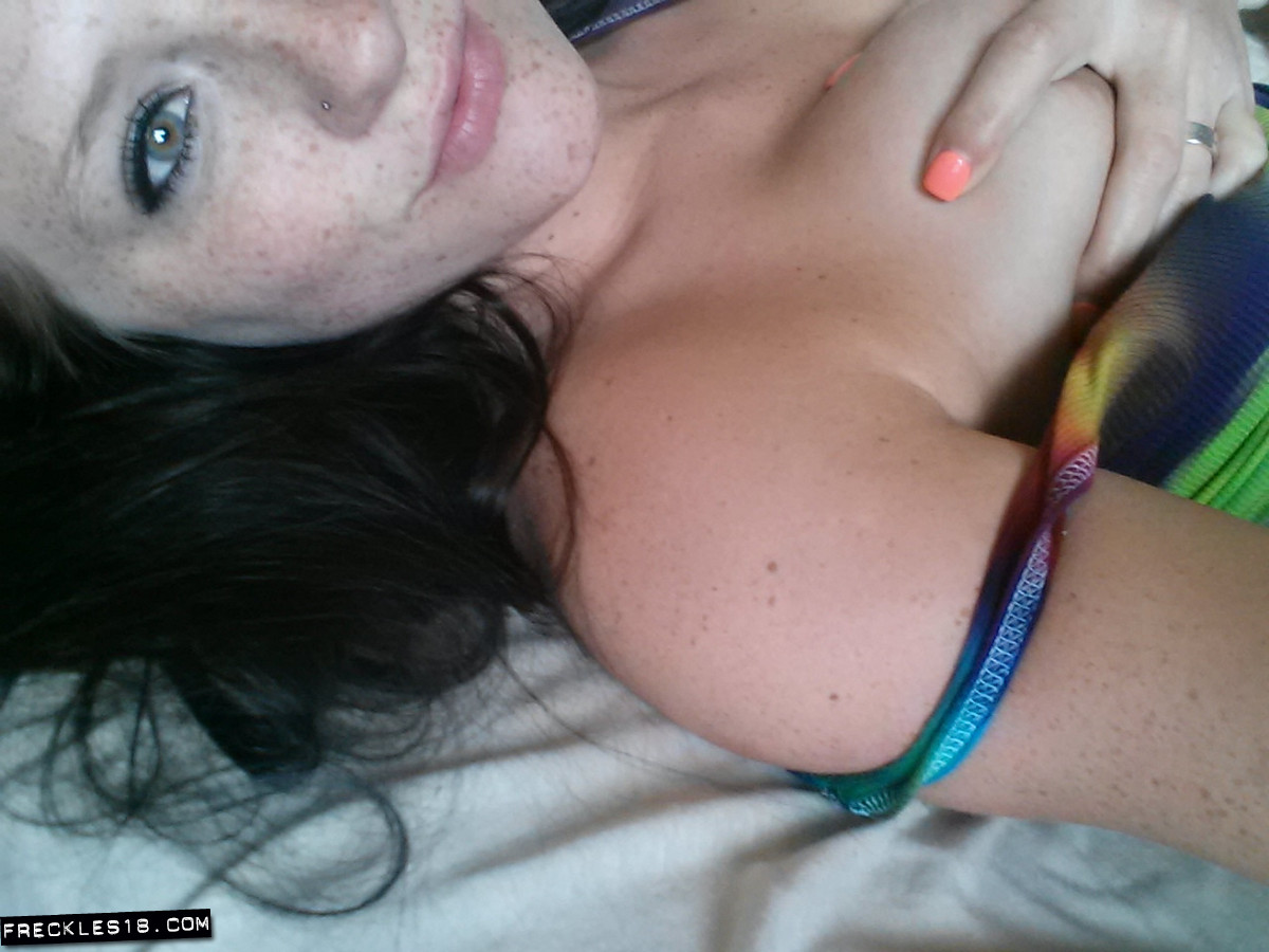 Freckles 18 Videos